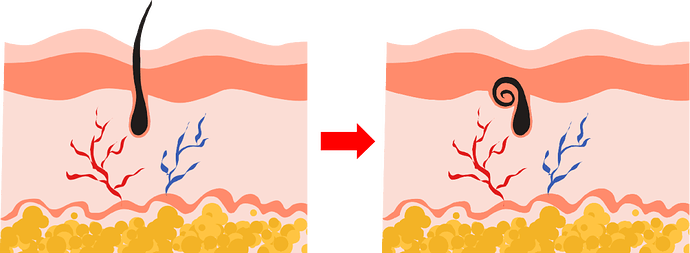 图1 裸鼠毛发生长示意图