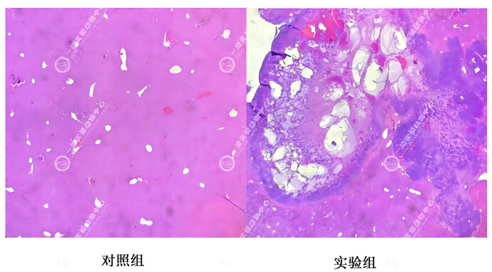 图 3：原位肝癌模型肝脏 HE 染色